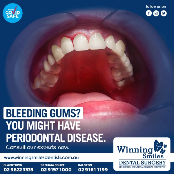 Bleeding Gums? You might have periodontal disease. Consult our experts now.