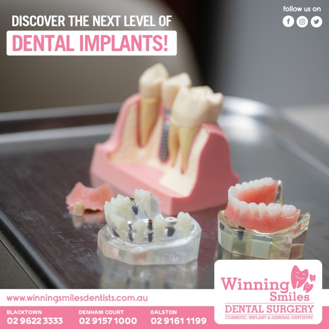 Discover the Next Level of Dental Implants